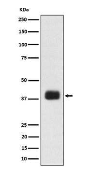 SR protein repeat Rabbit Monoclonal Antibody