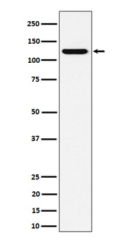 Anti-PKN2 Rabbit Monoclonal Antibody