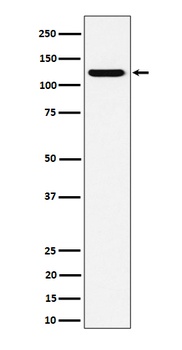 PKN2 Rabbit Monoclonal Antibody