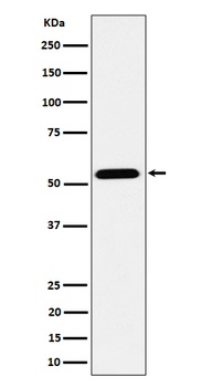 ENPP5 Rabbit Monoclonal Antibody