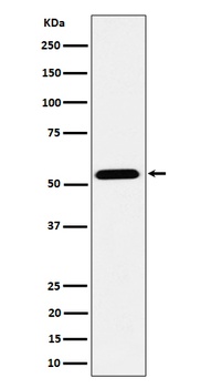 Anti-ENPP5 Rabbit Monoclonal Antibody