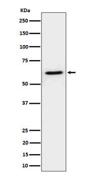 Anti-IKZF3 Rabbit Monoclonal Antibody