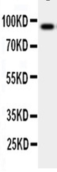 GCSF Receptor/CSF3R Antibody