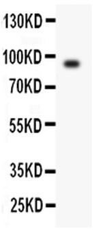 Anti-Periostin/POSTN Antibody