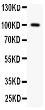 Prothrombin/F2 Antibody