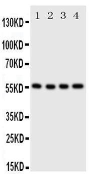 Anti-Glucose Transporter 5 GLUT5/SLC2A5 Antibody