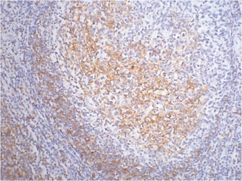 CD23 antibody