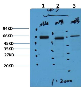 CK7 antibody