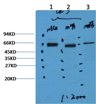 CK7 Mouse mAb