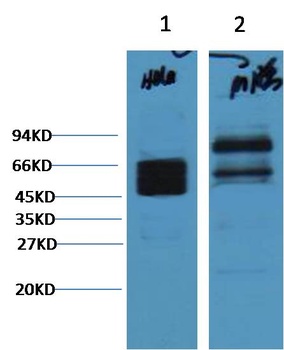 CK8 antibody