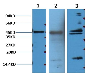 Aquaporin 4 antibody