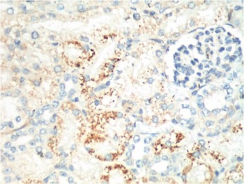 Ki 67 antibody