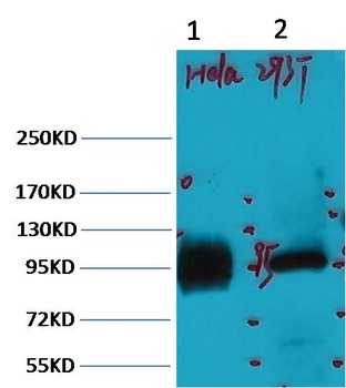 ABCB5 antibody