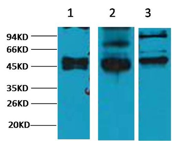 CK17 antibody