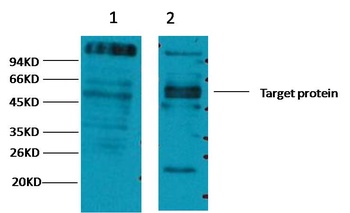 CD23 antibody