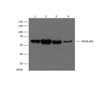 NFkB p65 Mouse mAb
