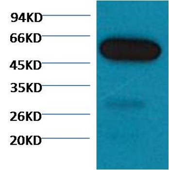 β I tubulin Mouse mAb