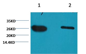 GFP-Tag antibody