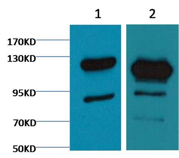 Cleaved PARP Mouse mAb