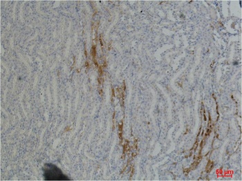 Fibronectin Mouse mAb