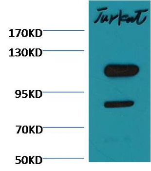 Cleaved PARP antibody