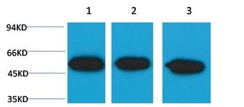 β III tubulin Mouse mAb