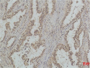 P53(Mono Methyl Lys370) Mouse mAb