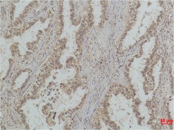 P53 (Mono Methyl Lys370) antibody