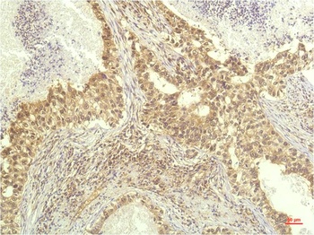 P70 S6 Kinase antibody