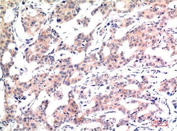 Acetyl-Histone H3 (K9) (2E7) Mouse mAb