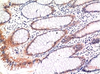 phospho-MLKL (S358) (6B4) Mouse mAb