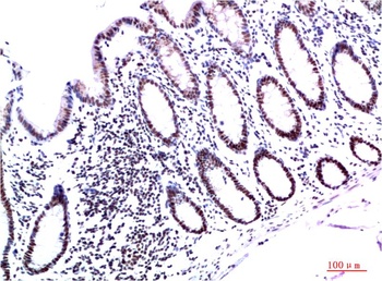 HP-1gamma antibody