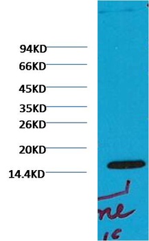 Histone H3 (di methyl K79) Monoclonal antibody