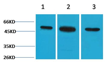 β II Tubulin Rabbit pAb