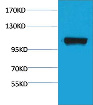 PEPC Rabbit pAb