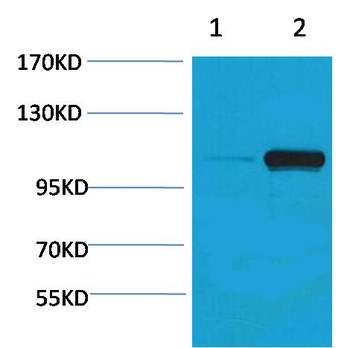 PEPC(Phospho Ser15) Rabbit pAb