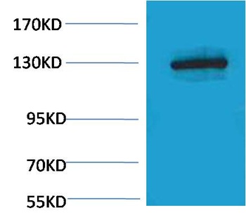 E-Cadherin antibody