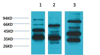 Angiotensin (1-7) Mas Receptor antibody