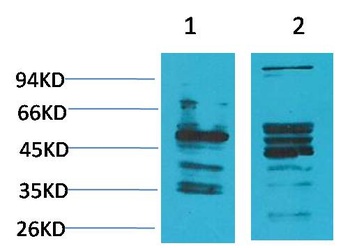 NMBR (Bombesin Receptor 1) Rabbit pAb