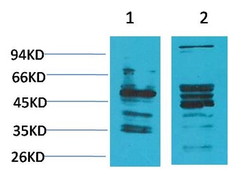 NMBR (Bombesin Receptor 1) antibody