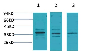 Cav gamma2 antibody