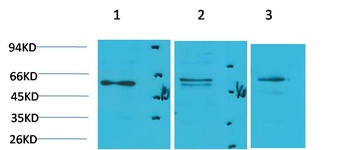 PPAR gamma antibody