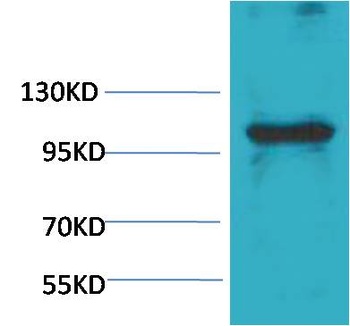 eEF1A2 binding protein antibody