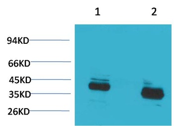 CABP Rabbit pAb