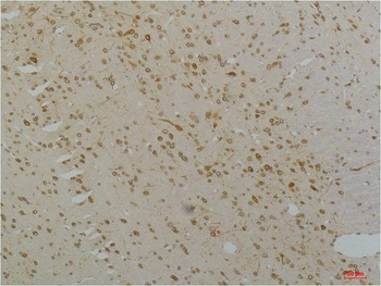 Cav1.2 antibody