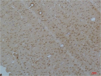 Cav pan alpha1 antibody