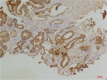 Endothelin B Receptor Rabbit pAb