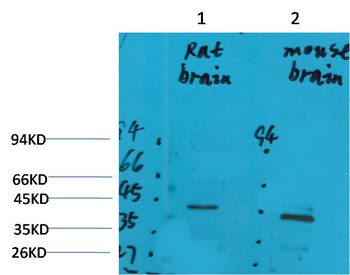 GALR2 antibody