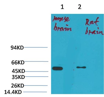 Kv1.1 potassium channel antibody