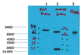 KCNN2 (SK2) antibody